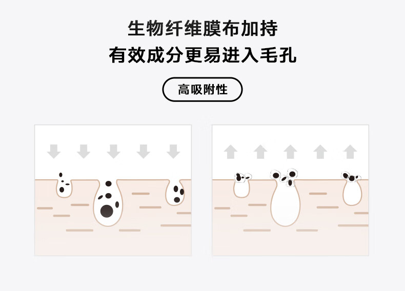 柏翠丝（Bytree's）去黑头鼻贴粉刺深度清洁器收细毛孔鼻膜导出男女黑头铲 净护黑头套盒