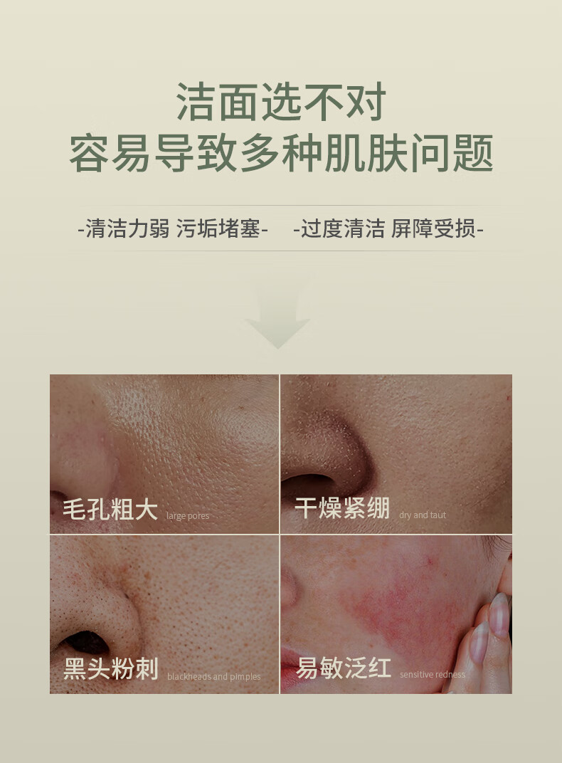 SKISGEM德国进口去黑头粉刺氨基酸控油除螨洗面奶男女士去角质洁面慕斯男 【清黑头收毛孔】洁面慕斯240ml