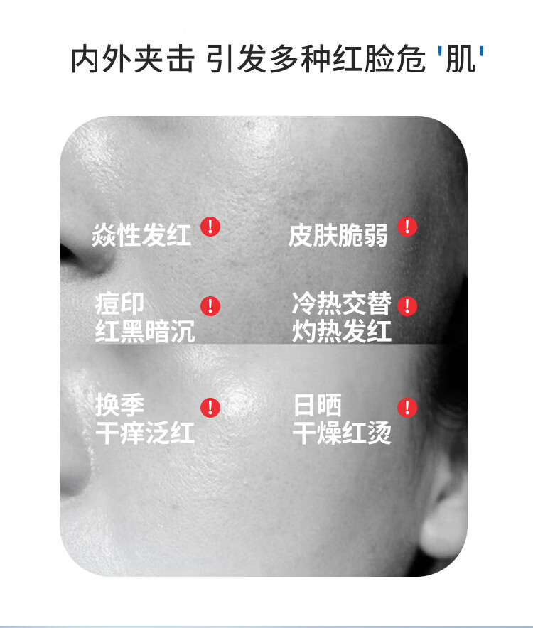 皮宝舒缓修护精华液敏感肌面部精华肌肤屏障维稳保湿小蓝瓶护肤品 精华液30ml*1