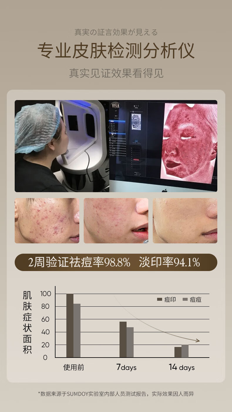 SUMDOY日本进口壬二酸祛痘印痘坑修复膏去痘红肿淡化痘印痘疤女男士 祛痘抑痘30g