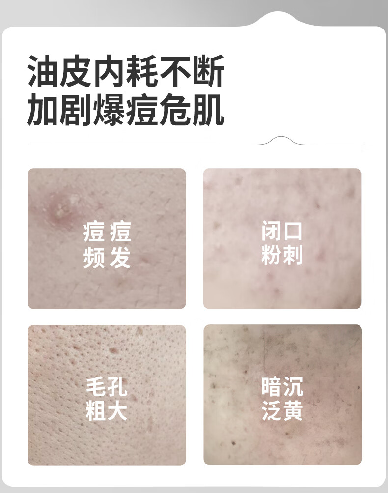 羽素毛孔收敛水去闭口控油无酸可湿敷收缩毛孔精萃爽肤水护肤补水 祛痘精华15ml+水200ml