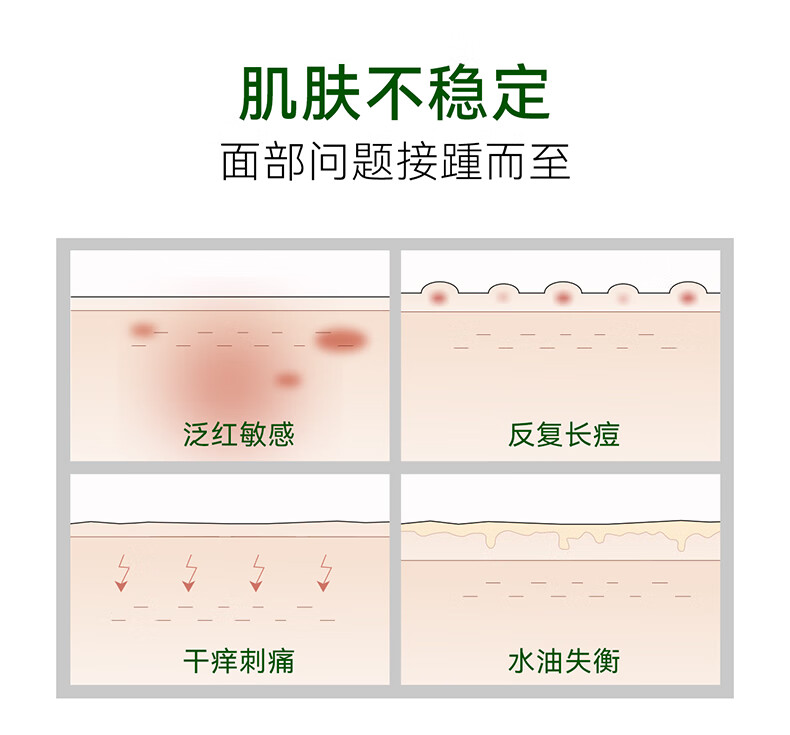 安修泽（ONCUR）油橄榄精华 面部修护精华油液态修红舒缓呵护敏感 30ml清爽版new