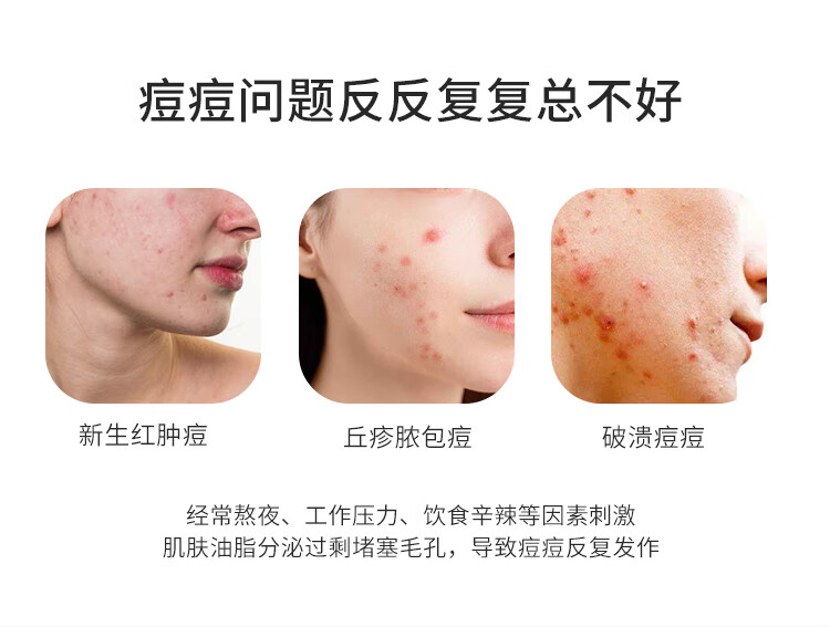 皮宝舒缓修护油痘敏感肌维稳强韧屏障调理闭口粉刺补水保湿温和战痘 点痘精华15克