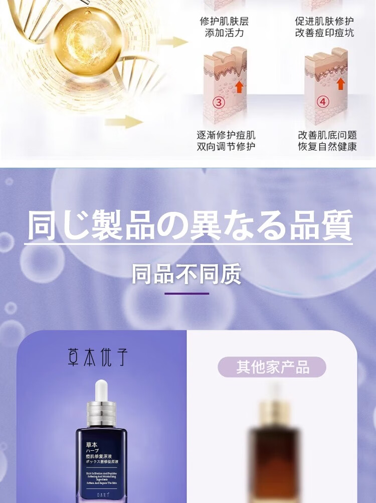 NHFOUYOU祛痘精华液祛痘膏去闭口粉刺痘坑痘印淡化消印收缩毛孔精华液 一瓶【30ml】建议按疗程使用