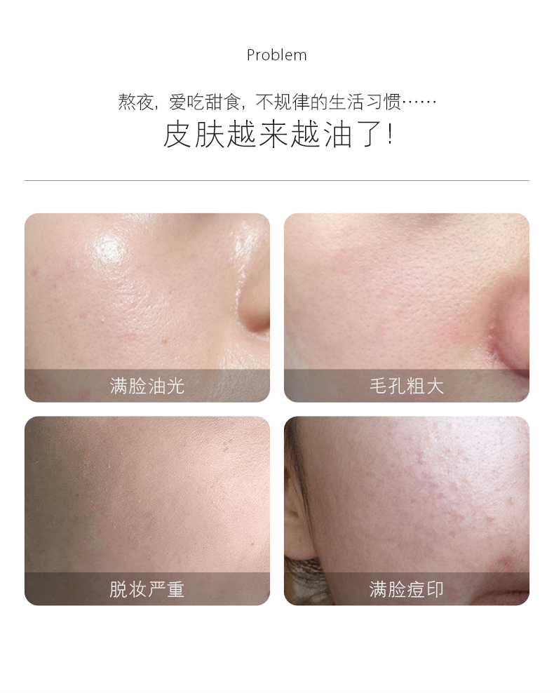 934酵母焕肤水爽肤水男女补水控油收敛毛孔943男女适用 【2瓶装】酵母水170ml*2