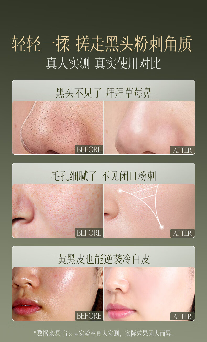 iFACE澳洲进口去角质去死皮面部深层清洁啫喱收缩毛孔去黑头脸部男女 磨皮去角质啫喱160ml