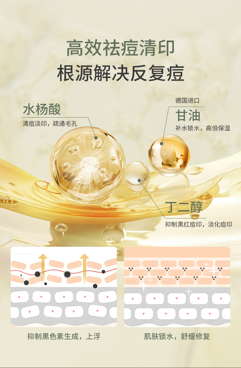 SKISGEM原装进口水杨酸祛痘精华液淡化痘印痘坑修复控油收缩毛孔男女士 【祛痘淡印】水杨酸精华液30ml