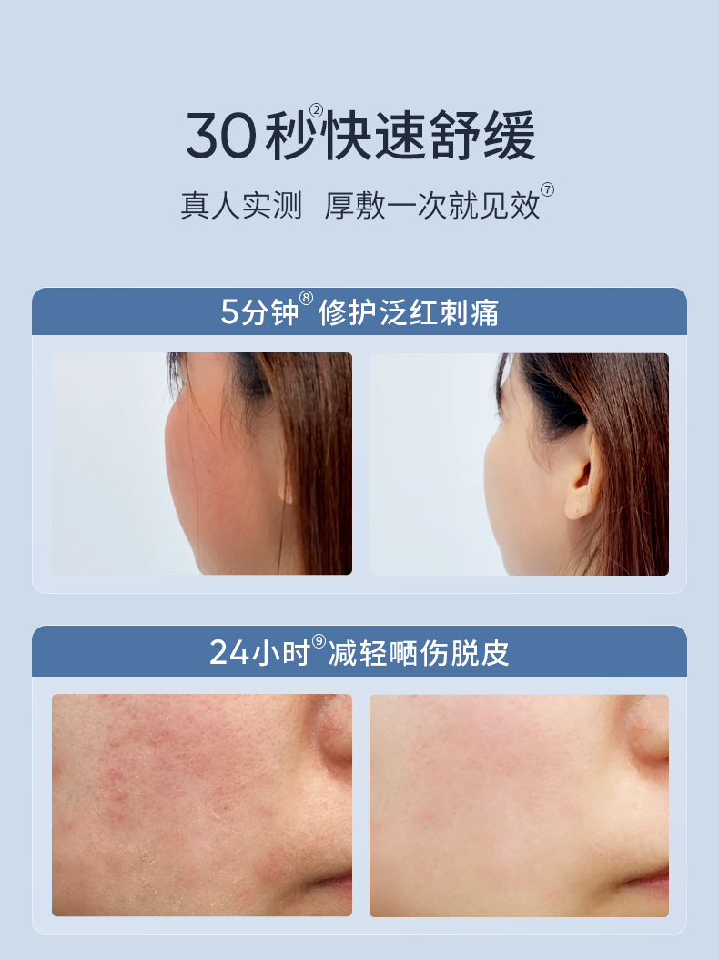 SUMDOY 日本进口晒后修复芦荟胶急救凝胶全身体皮肤屏障脸部晒黑伤修护 200g（舒缓深层修护）