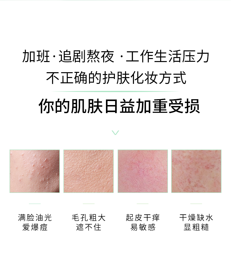 XDG第三代酵母益生菌控油修护精华水混油皮痘肌学生女爽肤水男护肤品 第三代益生菌精华水100ml