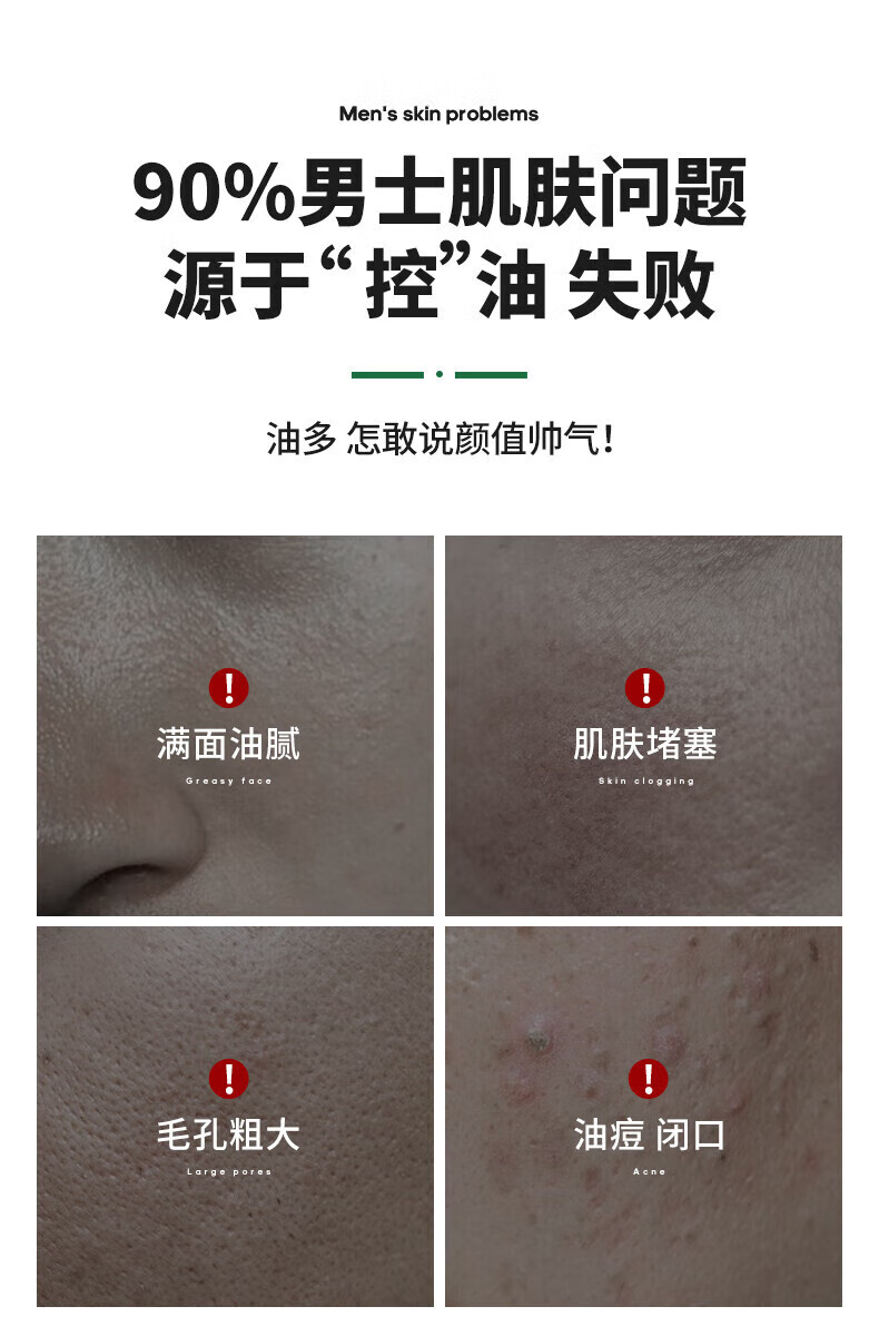 阿迪达斯 （adidas）控油洁面膏去油清爽洗面奶洁面乳组合 炭爽洁面膏100g+炭爽50g