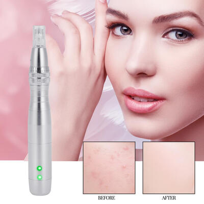 Greensen Anti-aging 7 LED Color Light Photon Electric Derma Pen With Nano Micro Needle Derma Pen Auto Micro Needle Pen
Greensen Anti-aging 7 LED Color Light Photon Electric Derma Pen With Nano Micro Needle Derma Pen Auto Micro Needle Pen