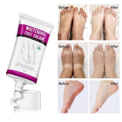 50ml Heel Crack Repair Cream Anti Crack Whitening Cream Foot Peeling Cracked Hands Feet Dry Skin Moisturizing Care
50ml Heel Crack Repair Cream Anti Crack Whitening Cream Foot Peeling Cracked Hands Feet Dry Skin Moisturizing Care