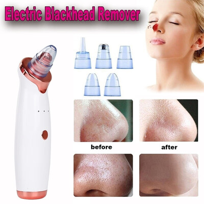 2019 New Electric Skin Care Facial Pore Cleanser Blackhead Acne Vacuum Cleaner Remover
2019 New Electric Skin Care Facial Pore Cleanser Blackhead Acne Vacuum Cleaner Remover