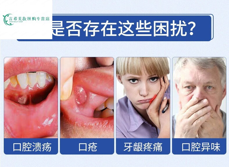 舌头起泡生疮植物草本口腔溃烂牙疼修正口咽冷敷凝露修正口咽喉爽2盒