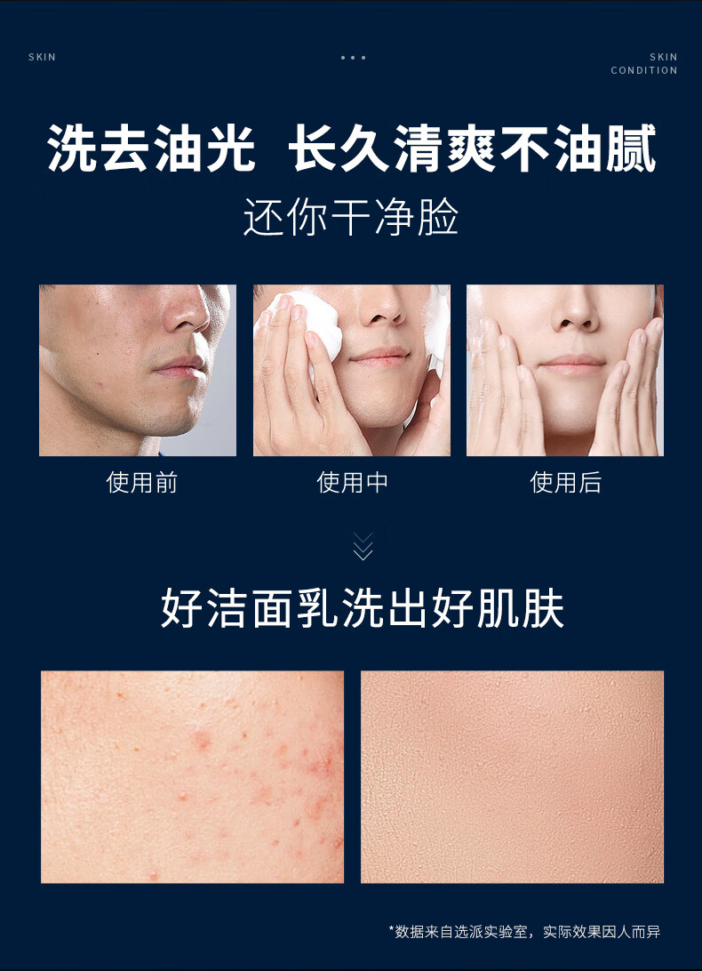 选派蓝色劲爽洁面乳控油补水保湿深层清洁氨基酸洁面乳 1瓶装