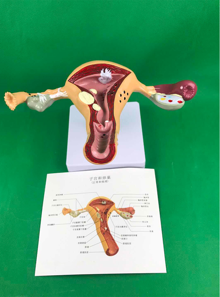 人体子宫模型教具模具卵巢解剖病理医学女性仿真女性生殖模器a款病理