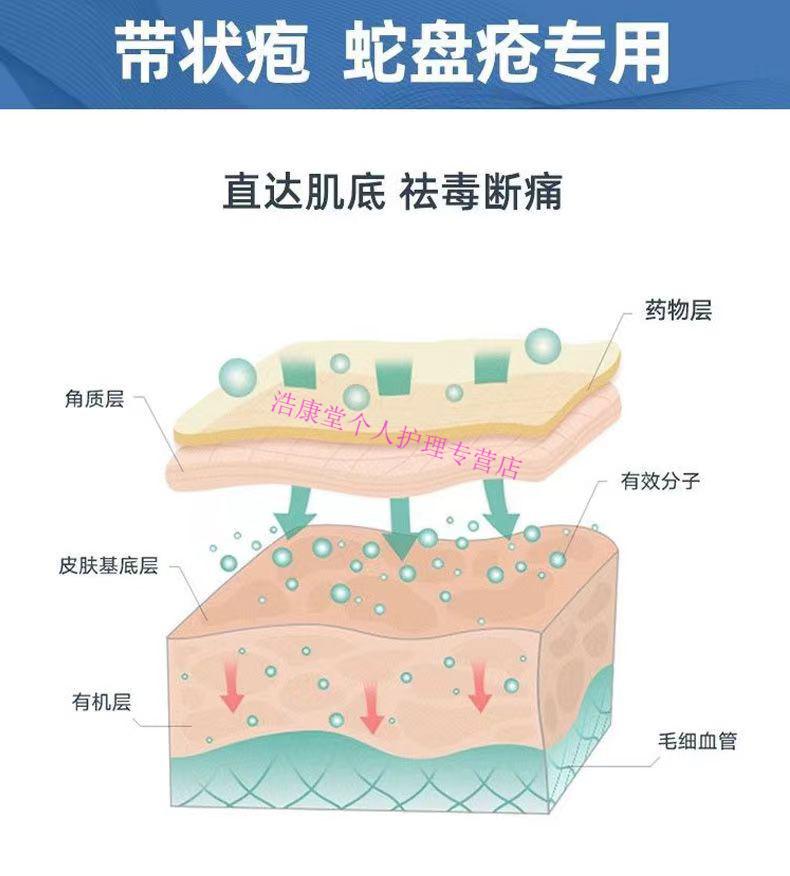 青木岳修因卡那a型红言蛇丹加丹b型辉王e型群泰盘云谷蛇盘飞蛇缠腰