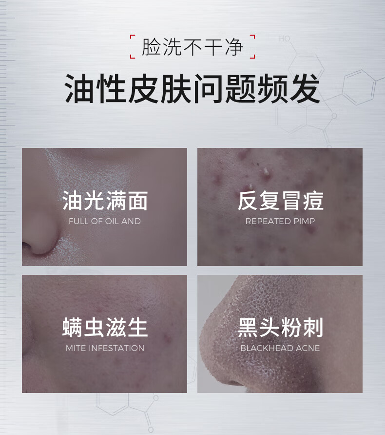 ning新加坡进口氨基酸洗面奶男女洁面乳控油深层清洁去黑头收毛孔祛痘 【去黑头油痘】洗面奶100g