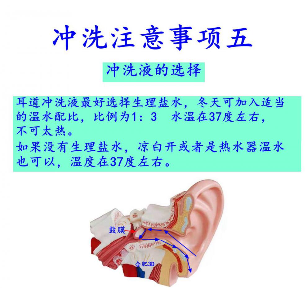 耳朵清洗器洗耳朵耳道冲洗器洗耳器冲洗耳朵采耳店洗耳朵家用冲洗耳道