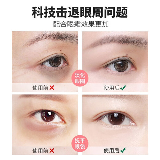 J Jingdika Eye Bag Removal Instrument, Special Instrument for Eye Bag Removal for Men and Women, Deluxe Introduction Instrument - with Constant Temperature Hot Compress Function - J Jingdika Eye Bag Removal Instrument, Special Instrument for Eye Bag Removal for Men and Women, Deluxe Introduction Instrument - with Constant Temperature Hot Compress Function -