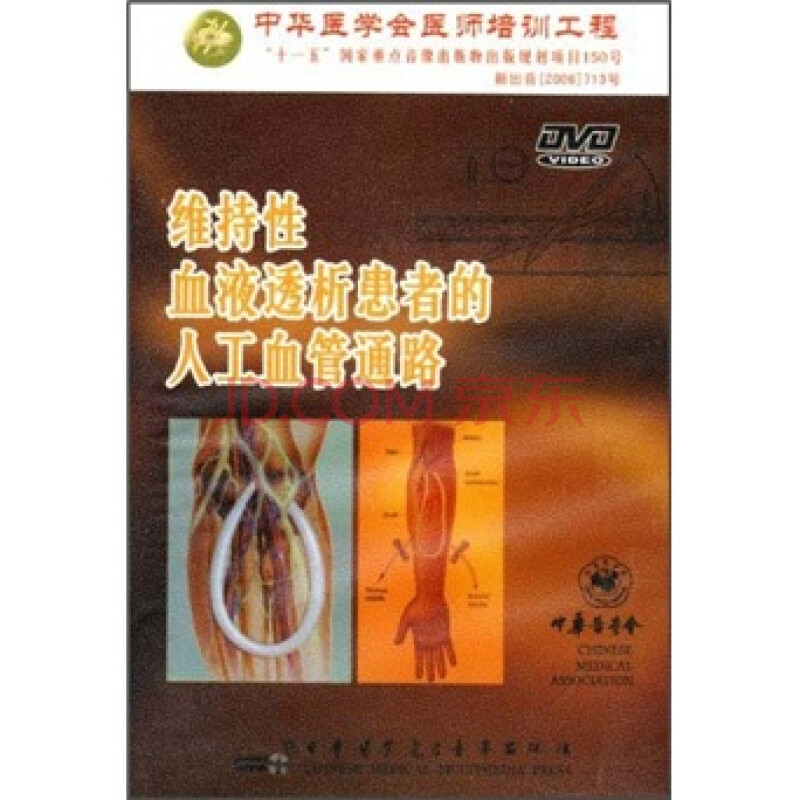 维持性血液透析患者的人工血管通路(dvd)