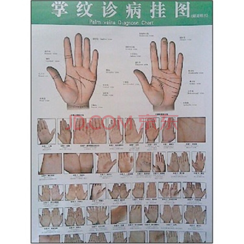 掌纹诊病挂图