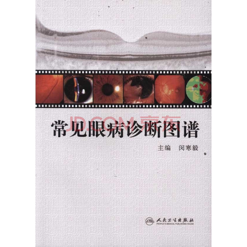 常见眼病诊断图谱