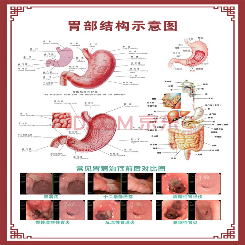 胃部结构示意图 pp胶(背面带胶)