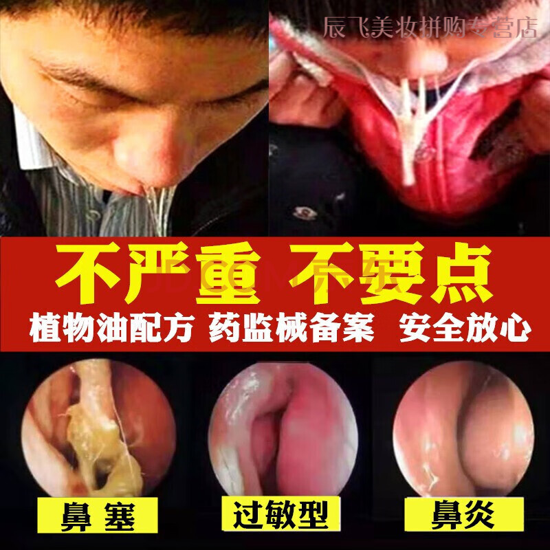 儿童过敏性鼻塞鼻干流鼻涕 鼻甲肥大鼻息肉鼻粘膜不通