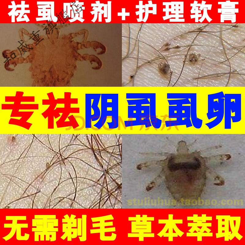 皇友3号祛除虱子阴虱卵喷雾剂康肤虱宁友皇3号男士女杀虫剂清虱净三号