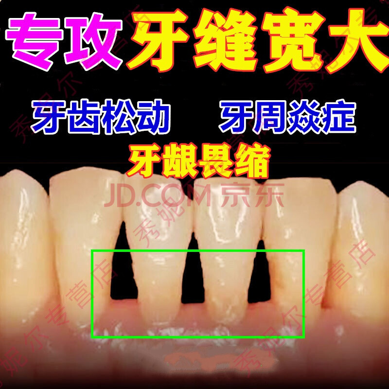 牙可舒冷敷凝胶义齿安固膏牙齿松动固定器牙齿过敏牙龈出血牙结石牙缝