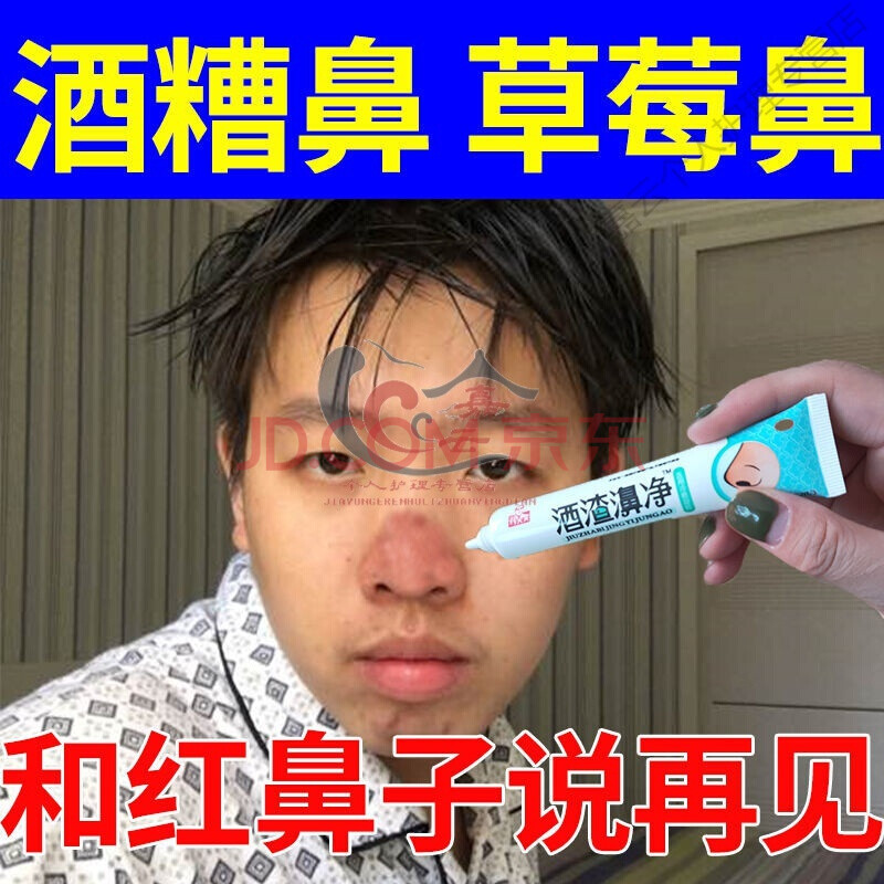 草莓鼻红血丝去黑头粉刺酒糟鼻修复红鼻子软膏除i螨虫痘痘红鼻头