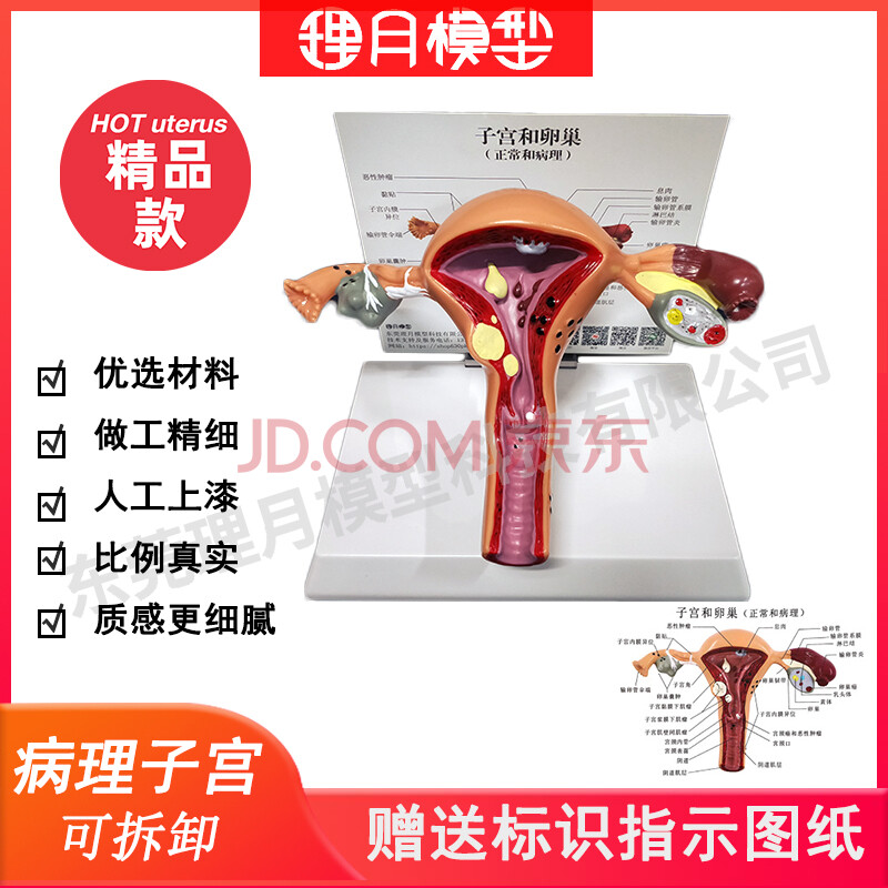 人体子宫模型教具模具卵巢解剖病理医学女性仿真女性生殖模器a2精品款