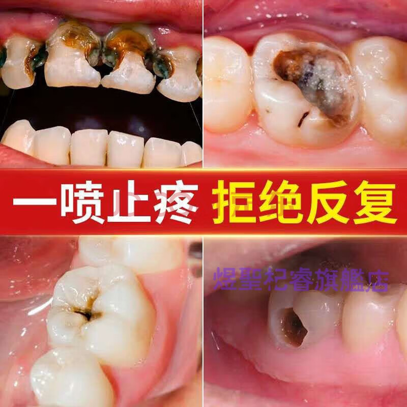 信民堂一号牙痛牙疼喷剂大夫立宁妙秒众宁尼坤荣福堂