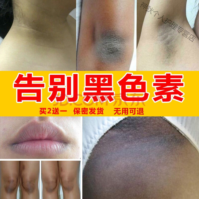 脖子去l黑关节黑色素颈部沉淀全身关节身体黑棘皮洗不干净美l白非去l