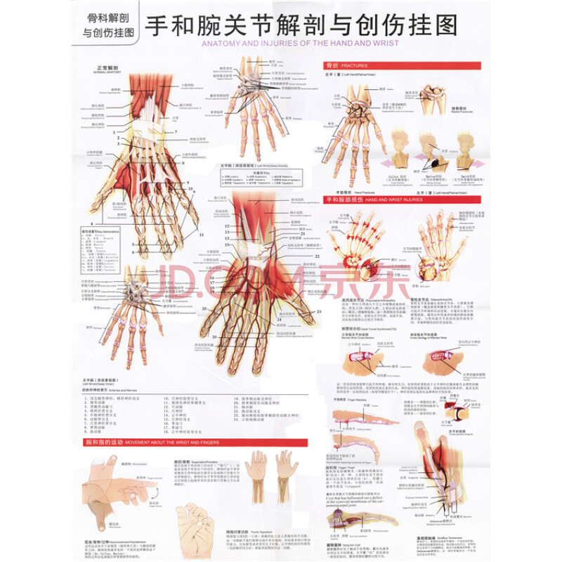 【凤雏家居】人体解肩关节手和腕关节解剖与创伤挂图贴画医院诊所骨科