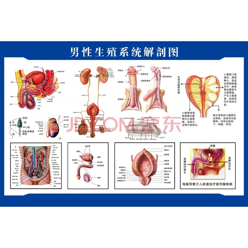 女性生殖器解剖图 医院宣传挂图子宫 妇科海报宫颈疾病示意图 sz-3