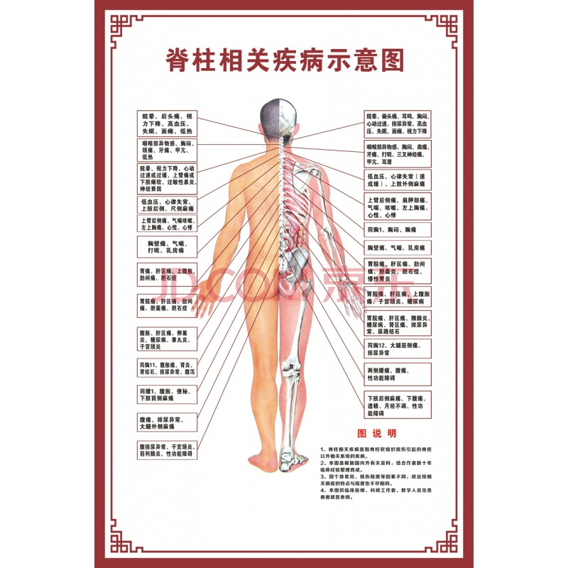 脊柱相关疾病示意图   【24寸:40x60cm】 pp胶(背面带胶)