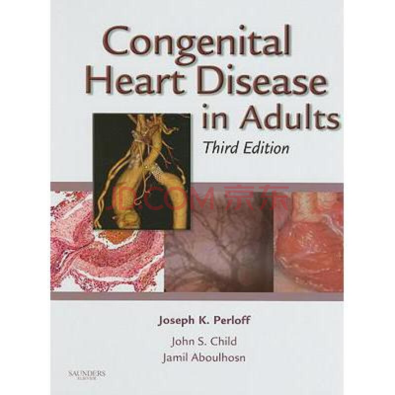congenital heart disease in adults