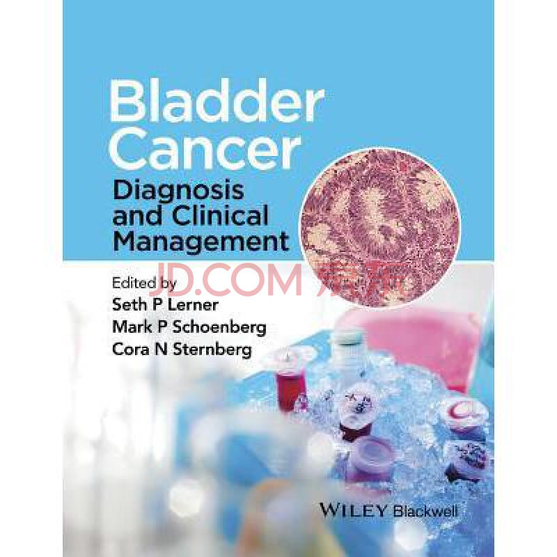 bladder cancer: diagnosis and clinical m.