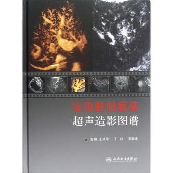 实用肝脏疾病超声造影图谱(精)【图片 价格 品
