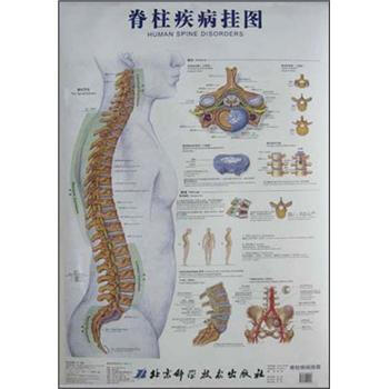《脊柱疾病挂图》([美]Anatomical Chart Comp