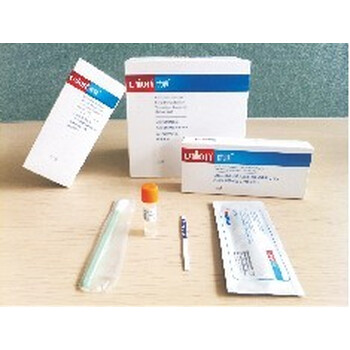 优联艾滋病检测口腔粘膜渗出液人类免疫缺陷病