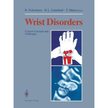 预订 wrist disorders: current concepts and challenge