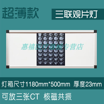 吉孚医疗医院x光led观片灯箱牙科看片阅片灯单双三四联骨科观片灯型