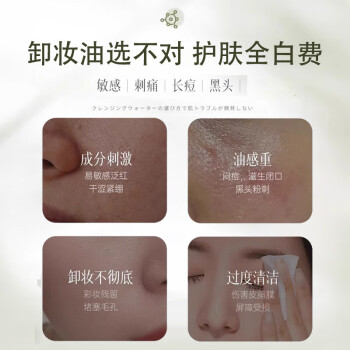 BEAI黑茶卸妆油眼唇脸三合一敏感肌温和植萃层清洁毛孔卸妆乳水225ml