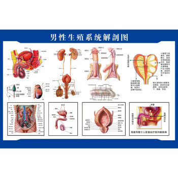 女性生殖器解剖图 医院宣传挂图子宫 妇科海报宫颈疾病