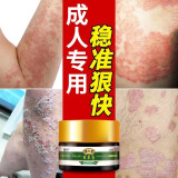 汉九宫百草膏成人癣头癣大腿内侧皮肤癣外阴囊肛门肛周瘙痒慢性干性