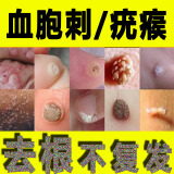 刺去除膏跖疣神器血泡刺药去修子鱼鳞痣贴休子猴子瘊子点痦子