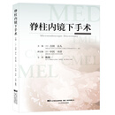 脊柱内镜下手术